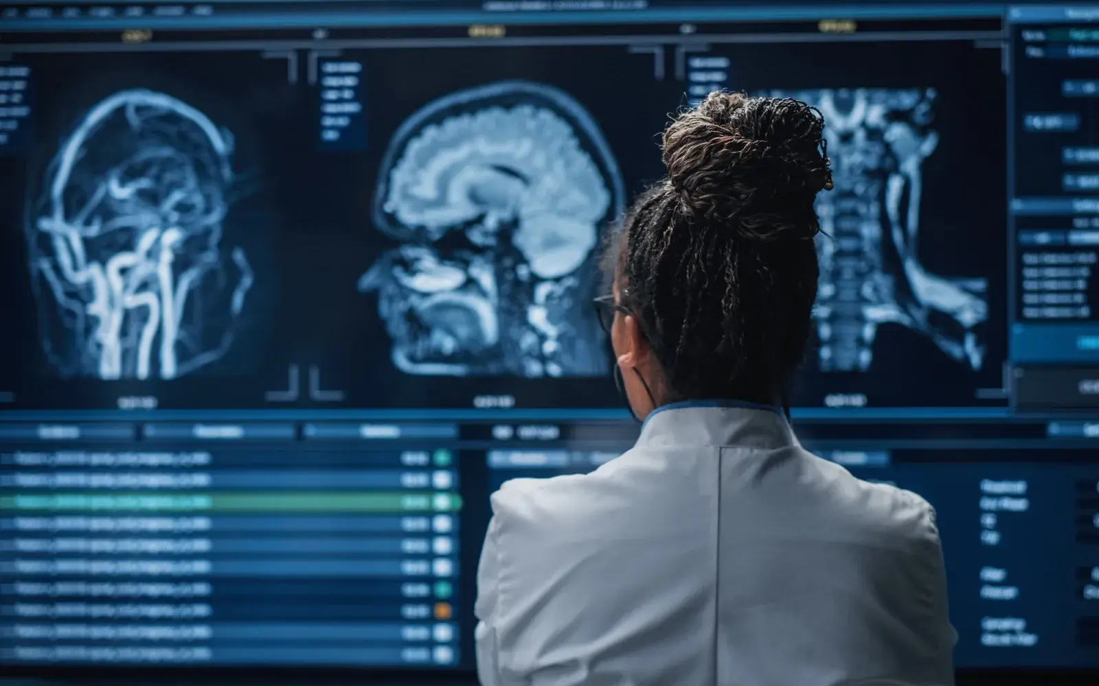 Radiologist reviewing brain MRI scans in a reading room